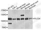Phospholipase C Delta 4 antibody, A7841, ABclonal Technology, Western Blot image 