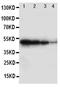 CDw293 antibody, PA2017, Boster Biological Technology, Western Blot image 