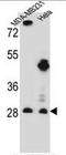 Eukaryotic Translation Initiation Factor 4H antibody, AP51403PU-N, Origene, Western Blot image 