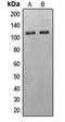 Erythrocyte Membrane Protein Band 4.1 Like 2 antibody, orb213897, Biorbyt, Western Blot image 