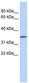F-Box Protein 31 antibody, TA335460, Origene, Western Blot image 