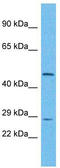 UTP11 Small Subunit Processome Component antibody, TA330817, Origene, Western Blot image 