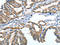 Angiopoietin 2 antibody, orb518523, Biorbyt, Immunohistochemistry paraffin image 