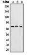 p65 antibody, LS-C352789, Lifespan Biosciences, Western Blot image 