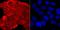 TAR DNA Binding Protein antibody, A01001-2, Boster Biological Technology, Immunocytochemistry image 
