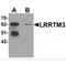 Leucine Rich Repeat Transmembrane Neuronal 3 antibody, MBS150313, MyBioSource, Western Blot image 