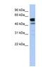 Lactate Dehydrogenase D antibody, NBP1-56558, Novus Biologicals, Western Blot image 