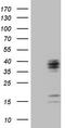 Chromosome 21 Open Reading Frame 62 antibody, TA808837S, Origene, Western Blot image 