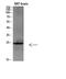 Interleukin 19 antibody, A04434, Boster Biological Technology, Western Blot image 
