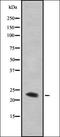 Human Immunodeficiency Virus Type I Enhancer Binding Protein 1 antibody, orb378285, Biorbyt, Western Blot image 