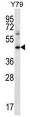 Interferon gamma receptor 1 antibody, AP52156PU-N, Origene, Western Blot image 