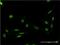 Fas-activated serine/threonine kinase antibody, H00010922-M02, Novus Biologicals, Immunocytochemistry image 