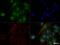 MYCN Proto-Oncogene, BHLH Transcription Factor antibody, NB200-109, Novus Biologicals, Immunofluorescence image 