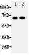 Growth Factor Receptor Bound Protein 10 antibody, PA1580, Boster Biological Technology, Western Blot image 