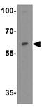 Zinc finger X-chromosomal protein antibody, GTX31851, GeneTex, Western Blot image 