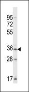 SH3 Domain Binding Kinase Family Member 3 antibody, PA5-48684, Invitrogen Antibodies, Western Blot image 