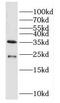 Dual specificity protein phosphatase 13 antibody, FNab02564, FineTest, Western Blot image 
