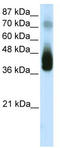 JunB Proto-Oncogene, AP-1 Transcription Factor Subunit antibody, TA330147, Origene, Western Blot image 