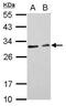 Cell Death Inducing DFFA Like Effector C antibody, PA5-30793, Invitrogen Antibodies, Western Blot image 