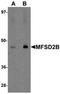 Major Facilitator Superfamily Domain Containing 2B antibody, orb75515, Biorbyt, Western Blot image 