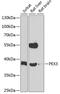 Peroxisomal Biogenesis Factor 3 antibody, GTX64847, GeneTex, Western Blot image 