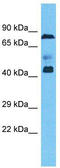 Zinc Finger Protein 362 antibody, TA339803, Origene, Western Blot image 