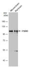 Discs Large MAGUK Scaffold Protein 2 antibody, GTX133244, GeneTex, Western Blot image 