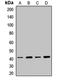 SH3 Domain Containing GRB2 Like 1, Endophilin A2 antibody, LS-C668264, Lifespan Biosciences, Western Blot image 
