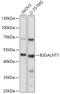 Beta-1,3-N-Acetylgalactosaminyltransferase 1 (Globoside Blood Group) antibody, 23-159, ProSci, Western Blot image 