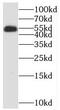 Myocyte Enhancer Factor 2C antibody, FNab05103, FineTest, Western Blot image 