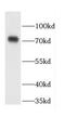Coiled-Coil Domain Containing 93 antibody, FNab01372, FineTest, Western Blot image 