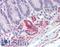 PKG1 antibody, LS-B3689, Lifespan Biosciences, Immunohistochemistry paraffin image 