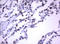 RAS Guanyl Releasing Protein 3 antibody, LS-C175628, Lifespan Biosciences, Immunohistochemistry paraffin image 