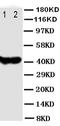 SRC Proto-Oncogene, Non-Receptor Tyrosine Kinase antibody, orb27624, Biorbyt, Western Blot image 