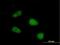 SIVA1 Apoptosis Inducing Factor antibody, H00010572-B01P, Novus Biologicals, Immunocytochemistry image 