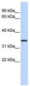 Mitochondrial Calcium Uniporter Regulator 1 antibody, TA336038, Origene, Western Blot image 