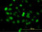Zinc Finger Protein 182 antibody, LS-C198460, Lifespan Biosciences, Immunofluorescence image 