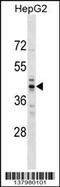TRNA Methyltransferase 10A antibody, 59-472, ProSci, Western Blot image 