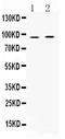 A-Kinase Anchoring Protein 2 antibody, A09279, Boster Biological Technology, Western Blot image 