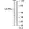 Ceramide kinase-like protein antibody, A09801, Boster Biological Technology, Western Blot image 