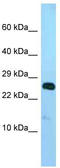 NADH:Ubiquinone Oxidoreductase Core Subunit V2 antibody, TA344742, Origene, Western Blot image 