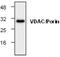 Voltage Dependent Anion Channel 1 antibody, GTX59911, GeneTex, Western Blot image 