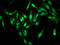 Protein Phosphatase 2 Phosphatase Activator antibody, LS-C377488, Lifespan Biosciences, Immunofluorescence image 
