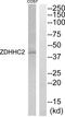 Zinc Finger DHHC-Type Containing 2 antibody, abx015069, Abbexa, Western Blot image 