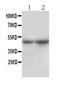 Solute Carrier Family 10 Member 1 antibody, GTX17430, GeneTex, Western Blot image 