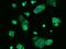 Ribosomal Protein S10 antibody, GTX02198, GeneTex, Immunofluorescence image 