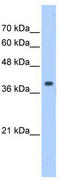 Eukaryotic translation initiation factor 3 subunit M antibody, TA346606, Origene, Western Blot image 