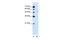 Solute Carrier Family 2 Member 6 antibody, PA5-42471, Invitrogen Antibodies, Western Blot image 