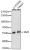 Single-minded homolog 2 antibody, A15098, ABclonal Technology, Western Blot image 