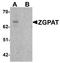 Zinc finger CCCH-type with G patch domain-containing protein antibody, A11540, Boster Biological Technology, Western Blot image 